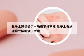 肚子上好像長(zhǎng)了一塊癬不疼不癢 肚子上有塊像癬一樣的偶爾會(huì)癢