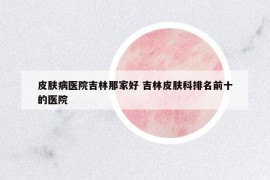 皮膚病醫(yī)院吉林那家好 吉林皮膚科排名前十的醫(yī)院