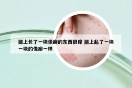 腿上長(zhǎng)了一塊像癬的東西很癢 腿上起了一塊一塊的像癬一樣