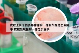 皮膚上長了很多那種像癬一樣的東西是怎么回事 皮膚出現(xiàn)像癬一樣怎么回事