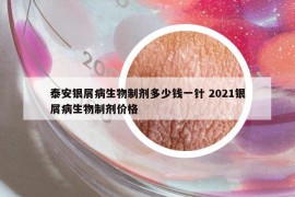 泰安銀屑病生物制劑多少錢一針 2021銀屑病生物制劑價格