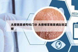 太原銀屑病?？崎T診 太原哪家銀屑病比較正規(guī)