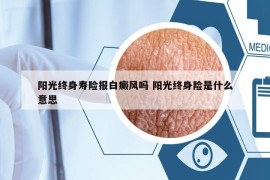 陽光終身壽險報白癜風嗎 陽光終身險是什么意思