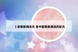 禤老銀屑病湯方 老中醫(yī)銀屑病湯藥配方