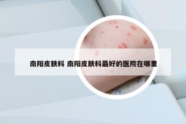 南陽(yáng)皮膚科 南陽(yáng)皮膚科最好的醫(yī)院在哪里