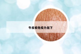 牛皮癬免疫力低下