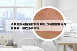 沙利度胺片能治療銀屑病嗎 沙利度胺片治療皮膚病一般吃多長時(shí)間