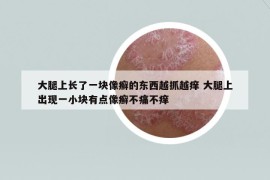 大腿上長(zhǎng)了一塊像癬的東西越抓越癢 大腿上出現(xiàn)一小塊有點(diǎn)像癬不痛不癢