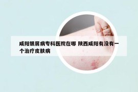咸陽(yáng)銀屑病?？漆t(yī)院在哪 陜西咸陽(yáng)有沒有一個(gè)治療皮膚病