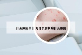 什么原因長(zhǎng)廯 為什么會(huì)長(zhǎng)癬什么原因