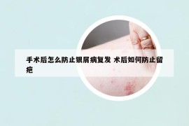 手術后怎么防止銀屑病復發(fā) 術后如何防止留疤
