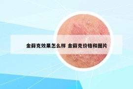 金蘚克效果怎么樣 金蘚克價(jià)格和圖片