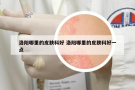 洛陽哪里的皮膚科好 洛陽哪里的皮膚科好一點(diǎn)