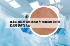 身上過敏起疙瘩很癢怎么辦 哺乳期身上過敏起疙瘩很癢怎么辦