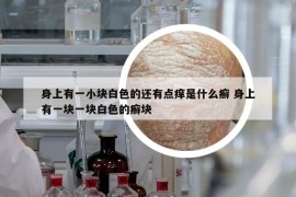 身上有一小塊白色的還有點(diǎn)癢是什么癬 身上有一塊一塊白色的癬塊