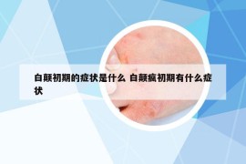 白顛初期的癥狀是什么 白顛瘋初期有什么癥狀