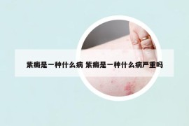 紫癜是一種什么病 紫癜是一種什么病嚴重嗎