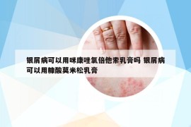 銀屑病可以用咪康唑氯倍他索乳膏嗎 銀屑病可以用糠酸莫米松乳膏