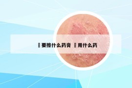 廯要擦什么藥膏 齁用什么藥