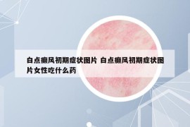 白點癲風初期癥狀圖片 白點癲風初期癥狀圖片女性吃什么藥
