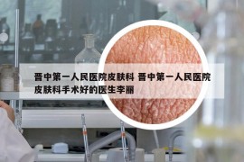 晉中第一人民醫(yī)院皮膚科 晉中第一人民醫(yī)院皮膚科手術(shù)好的醫(yī)生李麗