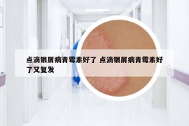 點(diǎn)滴銀屑病青霉素好了 點(diǎn)滴銀屑病青霉素好了又復(fù)發(fā)
