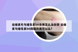 谷維素片與維生素b6合用怎么治白斑 谷維素與維生素b6同服作用可以么?