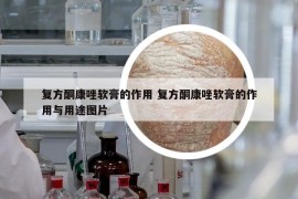 復方酮康唑軟膏的作用 復方酮康唑軟膏的作用與用途圖片