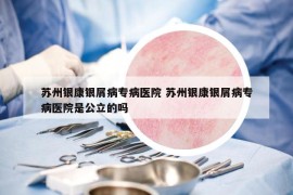 蘇州銀康銀屑病專病醫(yī)院 蘇州銀康銀屑病專病醫(yī)院是公立的嗎