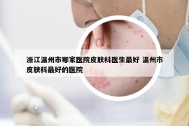 浙江溫州市哪家醫(yī)院皮膚科醫(yī)生最好 溫州市皮膚科最好的醫(yī)院
