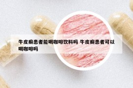 牛皮癬患者能喝咖啡飲料嗎 牛皮癬患者可以喝咖啡嗎