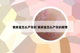 銀屑是怎么產(chǎn)生的 銀屑是怎么產(chǎn)生的原理
