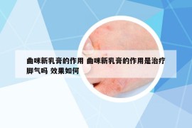曲咪新乳膏的作用 曲咪新乳膏的作用是治療腳氣嗎 效果如何