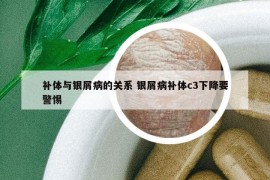 補(bǔ)體與銀屑病的關(guān)系 銀屑病補(bǔ)體c3下降要警惕