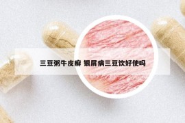 三豆粥牛皮癬 銀屑病三豆飲好使嗎