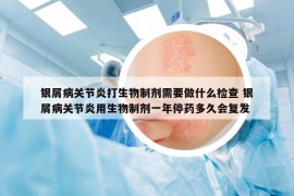 銀屑病關節(jié)炎打生物制劑需要做什么檢查 銀屑病關節(jié)炎用生物制劑一年停藥多久會復發(fā)