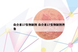 白介素17生物制劑 白介素17生物制劑齊魯