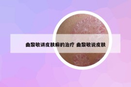 曲黎敏講皮膚癬的治療 曲黎敏說皮膚