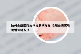 汝州金庚醫(yī)院治療皮膚病咋樣 汝州金庚醫(yī)院電話號碼多少