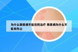 為什么銀屑病不能住院治療 銀屑病為什么不能有傷口