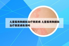 兒童服用胸腺肽治療銀屑病 兒童服用胸腺肽治療銀屑病有用嗎