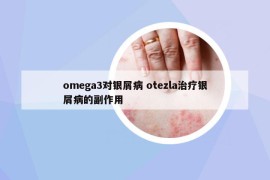 omega3對銀屑病 otezla治療銀屑病的副作用