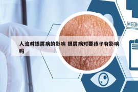 人流對(duì)銀屑病的影響 銀屑病對(duì)要孩子有影響嗎