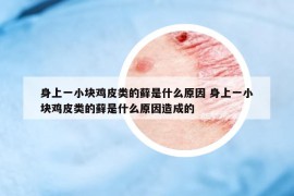 身上一小塊雞皮類的蘚是什么原因 身上一小塊雞皮類的蘚是什么原因造成的