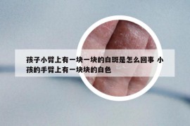 孩子小臂上有一塊一塊的白斑是怎么回事 小孩的手臂上有一塊塊的白色
