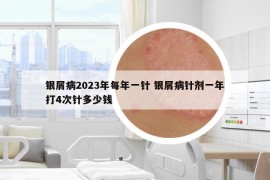 銀屑病2023年每年一針 銀屑病針劑一年打4次針多少錢