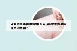 點狀型銀屑病初期癥狀圖片 點狀性銀屑病用什么藥物治療