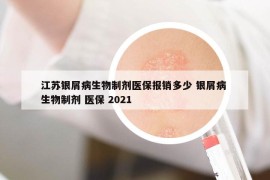 江蘇銀屑病生物制劑醫(yī)保報(bào)銷多少 銀屑病 生物制劑 醫(yī)保 2021