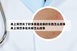 身上突然長了好多像是皮癬的東西怎么回事 身上突然多處長癬怎么回事