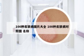 100種皮膚病圖片大全 100種皮膚病對照圖 名稱